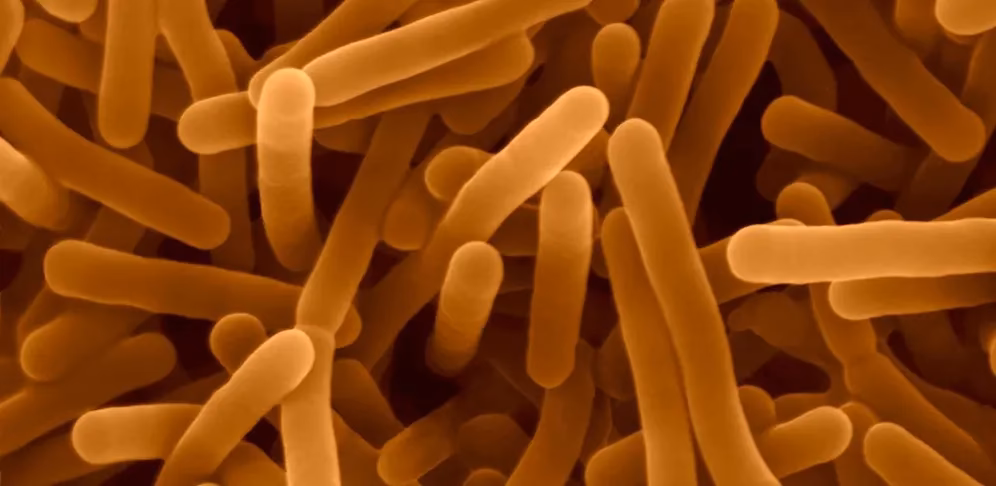 Was ist der Unterschied zwischen verschiedenen Listerien-Spezies?